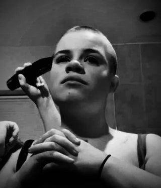 Why Alopecia is close to my heart